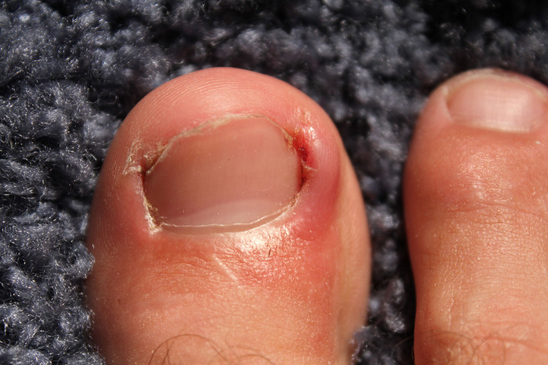 The Hidden Meaning Behind Your Toenail Polish Color - wide 10